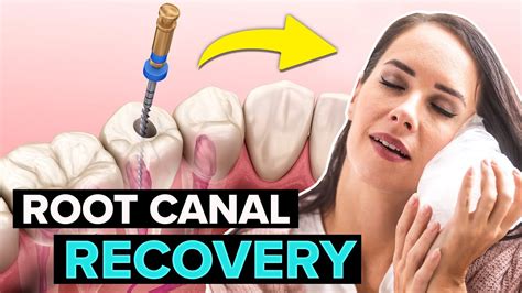 5 Root Canal Recovery Tips To Heal FAST! - YouTube