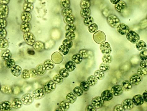 Photographic Print: Nostoc Cyanobacteria, with Heterocysts Important in ...