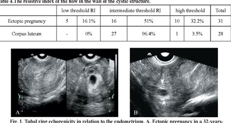 Corpus Luteum Ultrasound