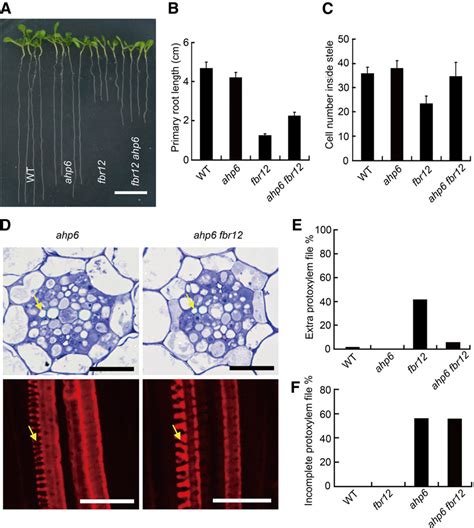 Figure 7 from The Arabidopsis Eukaryotic Translation Initiation Factor eIF5A-2 Regulates Root ...