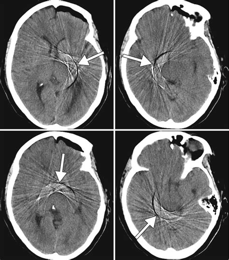 Computed Tomography | Radiology Key