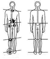 "Sacrum pain (sacroiliac joint pain)" that is not low back pain.