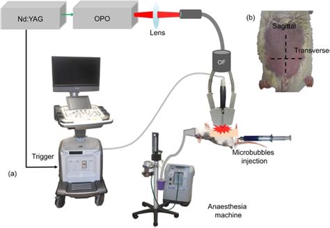 On-chip generation of microbubbles in photoacoustic contrast agents for dual modal ultrasound ...