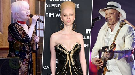 International Albinism Awareness Day 2020: Famous Albino Personalities ...