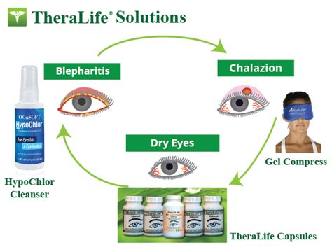 Powerful Chalazion Treatment With TheraLife