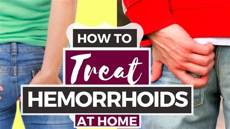 Hemorrhoids treatment at home - databasetiklo