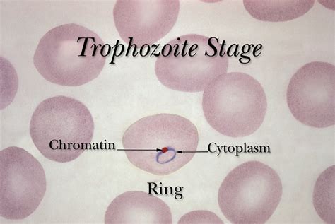 Public Domain Picture | The "Ring Stage" of an erythrocytic trophozoite of the Plasmodium spp ...