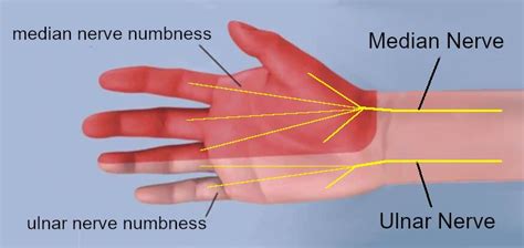 Causes of Finger Numbness (No. 3 May Shock You)