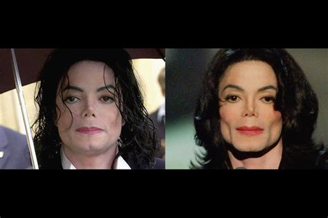 Michael Jackson After Surgery 2022