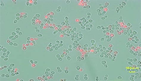 Saccharomyces cerevisiae strain I136 examination under fluorescent... | Download Scientific Diagram