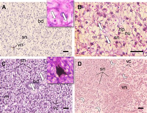 Liver histopathology of tested individuals. a Normal hepatic parenchyma... | Download Scientific ...