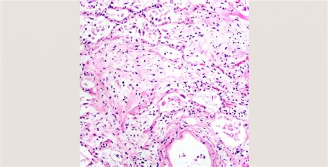 Pathology for COVID-19 Infectious Diseases