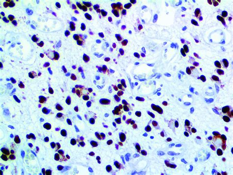 PRAME Antibody (RBT-PRAME) - Bio SB