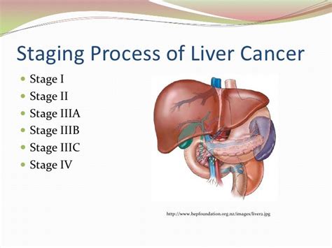 Liver Cancer