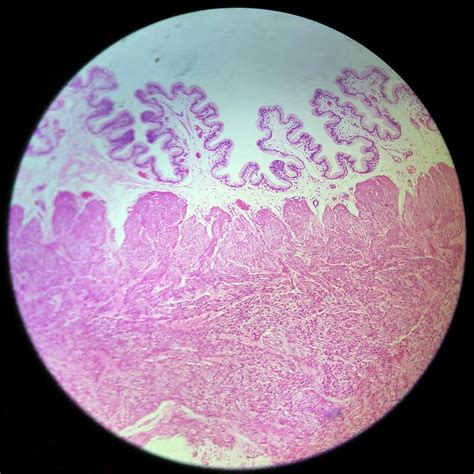 Human Cervix section prepared slides, 7 µm sec., H&E Stain, wholesale