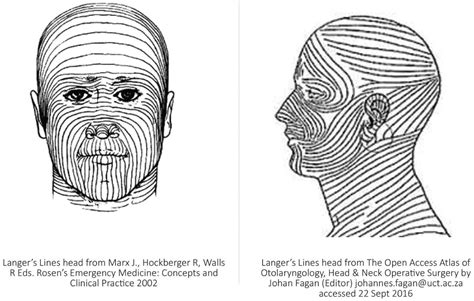 Biodynamic Excisional Skin Tension (BEST) Lines: Revisiting Langer’s Lines, Skin Biomechanics ...