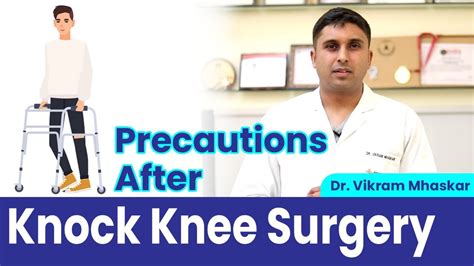 👉Post Knock Knee Surgery | Precautions After Knock Knee Treatment Recovery After Knock Knee ...