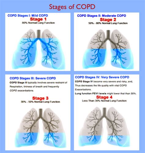 Understanding the 4 Stages of COPD