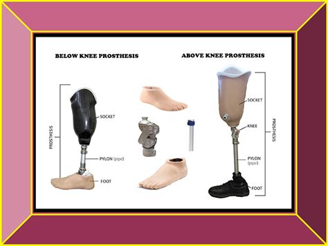 Prosthetics & Orthotics from My Care: Lower Limb Prosthesis