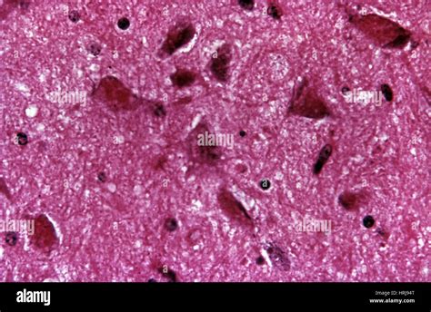 Rabies Virus, LM Stock Photo - Alamy