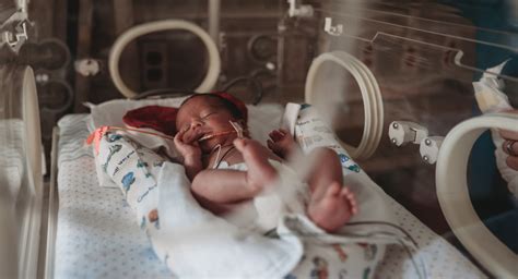 Preemie babies: Babies born at 32 weeks, 28 weeks, and earlier | BabyCenter