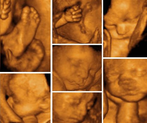 Life Through the Lens- 4D Baby Scan | Pregnancy Scanning: 4D Baby Scan: The Perfect Way to See ...