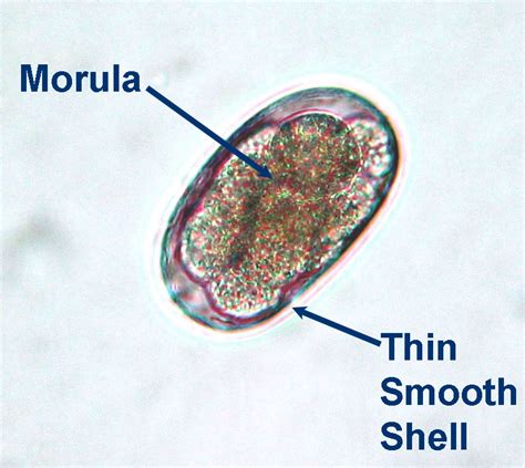 Ancylostoma Duodenale Morphology Labeled