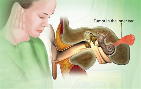 Health Condition : Symptoms, Causes, Treatment and More