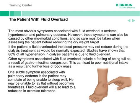 PPT - Fluid Management in Haemodialysis PowerPoint Presentation, free download - ID:6848124