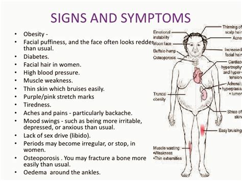 Signs and symptoms of adrenal cancers | Healthy Family