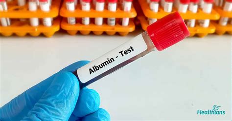 Serum Albumin Test: A test to check liver functions