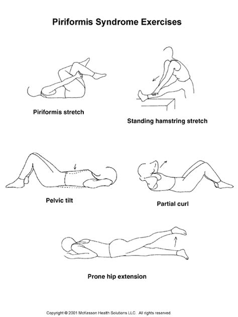 Sports Medicine Advisor 2003.1: Piriformis Syndrome Exercises: Illustration