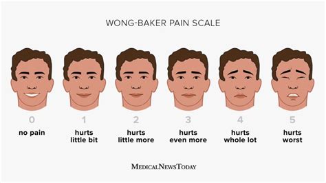 Wong-Baker pain scale: Uses, benefits, and more | Pain scale, Physical ...