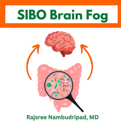 Is your GUT causing your BRAIN FOG? – OC Integrative Medicine