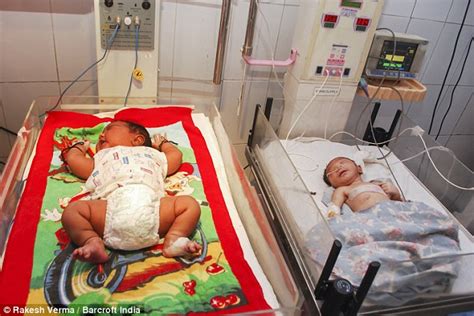 India's biggest baby ever born is a massive 13lb and has obesity risk | Daily Mail Online