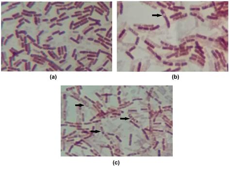 Endospores Under Microscope