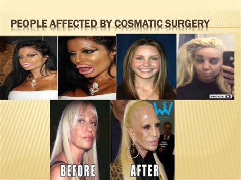 Risks in plastic surgery