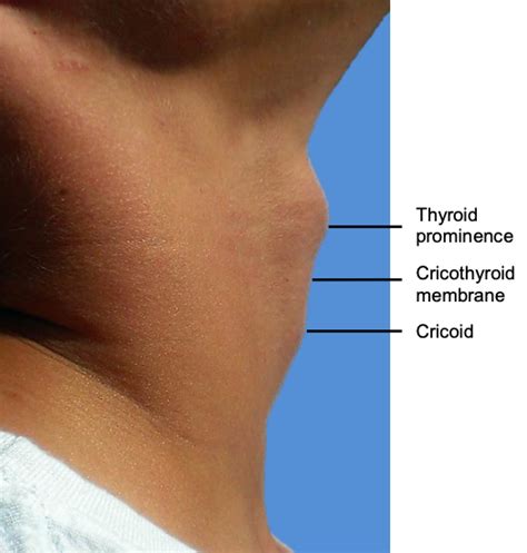 Unión El sendero prosperidad cricothyroid membrane surface anatomy ...