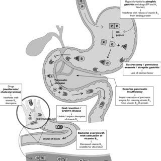 (PDF) Vitamin B12 deficiency in the elderly: Is it worth screening?