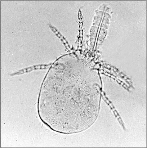 Trombiculidae - Wikiwand