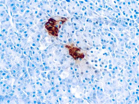 Pancreatic Polypeptide | Diagnostic BioSystems - Immunohistochemistry, Primary Antibodies ...