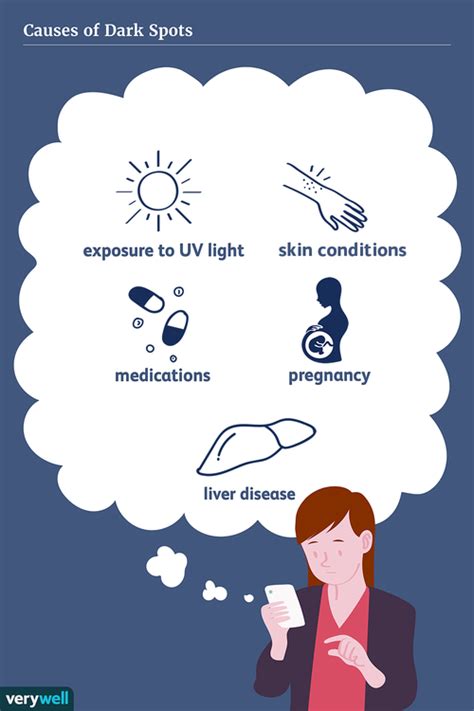 Dark Spots: Causes, Diagnosis, and Treatment