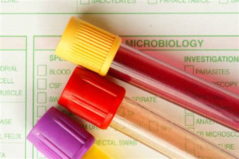 Lymphs Blood Test Shows High - Should I Be Concerned