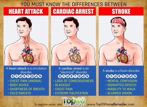 Understanding Heart Attack, Cardiac Arrest and Stroke | Top 10 Home ...