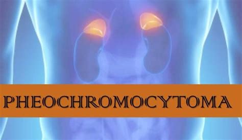 Pheochromocytoma : Causes, Picture, Symptoms And Treatment