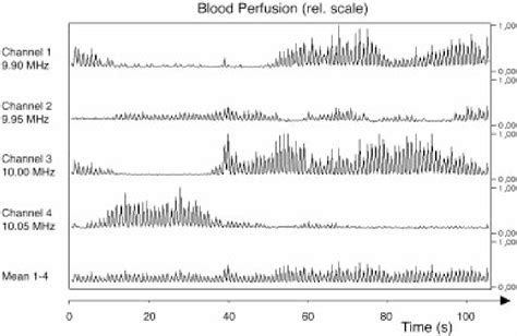 Figure 2 from Estimation of blood perfusion using ultrasound | Semantic ...