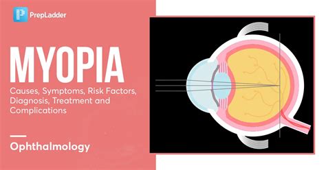 Myopia: Causes, Symptoms, Risk Factors, Diagnosis, Treatment and Complications