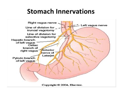 38 best central nervous system images on Pinterest | Fibromyalgia ...