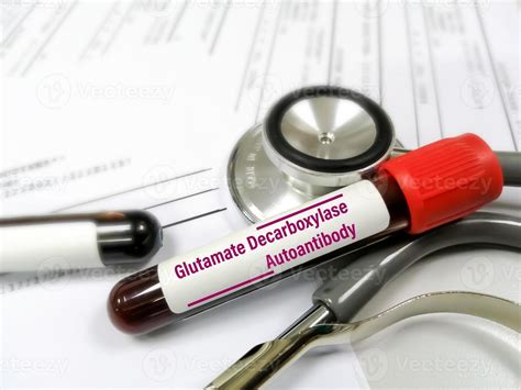 Blood sample for Glutamic acid decarboxylase antibody of GADA test 16785806 Stock Photo at Vecteezy