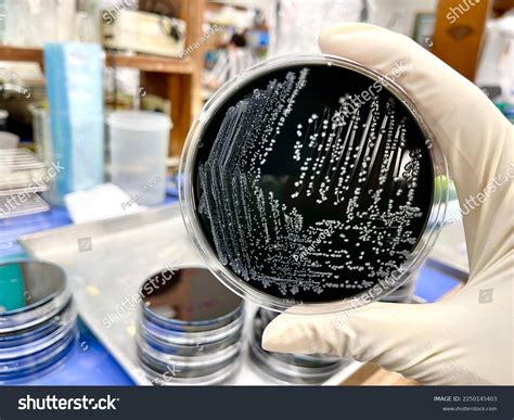 5 Campylobacter Jejuni Colony Images, Stock Photos & Vectors | Shutterstock